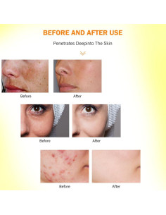 Aceite de Cúrcuma 100ml - Cuidado Natural para la Piel 2