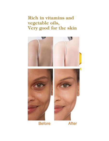 Jabón CARROT Soft 7 - Tratamiento Natural para Manchas 246g