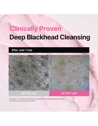 Limpiador Facial Espumoso Dewtox Lift 150ml - Piel Sensible