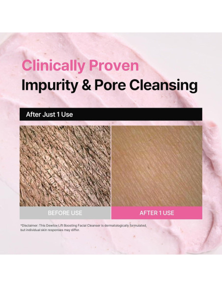 Limpiador Facial Espumoso Dewtox Lift 150ml - Piel Sensible