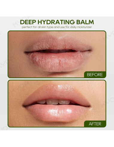Bálsamo Labial Hidratante KYDA Aloe Vera 3 Pcs 2.7g