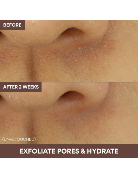 Mascarilla de Arcilla Super Volcánica Innisfree 109.73 g - Cuidado Piel