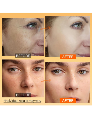 Hidratante Facial Vitamina C ULLUXE 65 g Antienvejecimiento