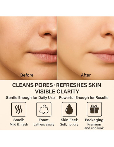 Jabón Natural de Carbón Activado Zohvia 125g - Limpiador Facial y Corporal