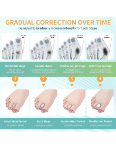 Separadores de Dedos de Gel Pitoyteck para Juanetes - Ajustables 2