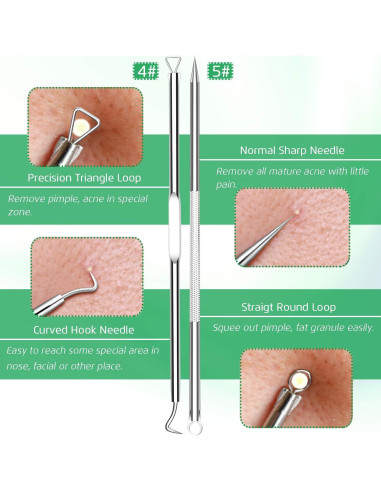Kit Extractor de Comedones 5 Piezas Kotomotoy Acero Inoxidable