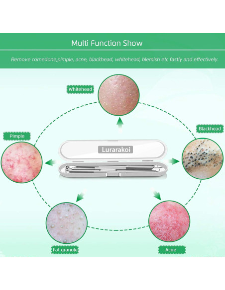 Kit Extractor de Comedones 5 Piezas Kotomotoy Acero Inoxidable
