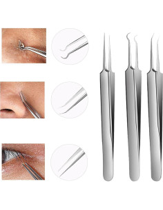 Kit de Pinzas para Puntos Negros WSYUB - Acero Inoxidable 3 en 1 2