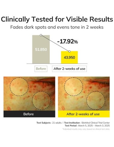 Suero Iluminador Keenoniks 30ml - 10% Niacinamida y Vitamina C