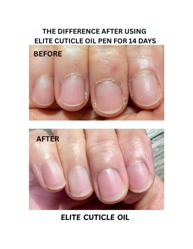 Bolígrafo Aceite para Cutículas Elite Naranja 17g Hidratante