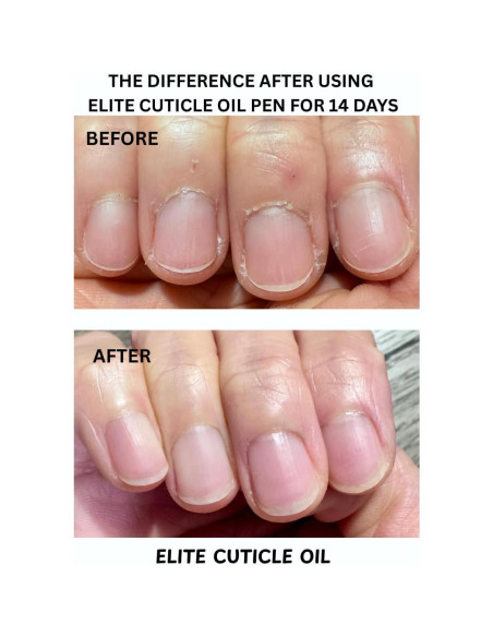 Bolígrafo Aceite para Cutículas Elite Naranja 17g Hidratante