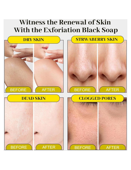 Jabón Negro Marroquí MR.A 100g Exfoliante Hidratante SPA