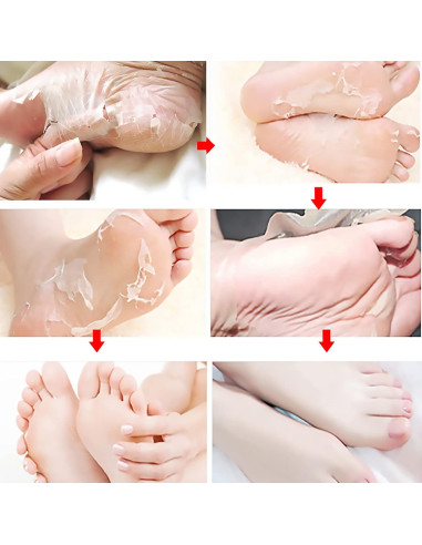 Máscara Exfoliante para Pies con Ácidos Frutales NutriPies