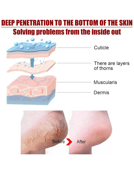 Máscara Exfoliante para Pies con Ácidos Frutales NutriPies Máscara Exfoliante para Pies con Ácidos Frutales NutriPies