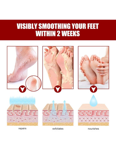 Máscara Exfoliante para Pies con Ácidos Frutales NutriPies