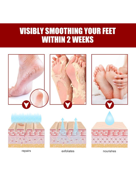 Máscara Exfoliante para Pies con Ácidos Frutales NutriPies Máscara Exfoliante para Pies con Ácidos Frutales NutriPies