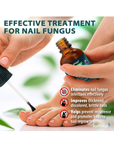 Tratamiento para Hongos en Uñas de Pies Swiftalyn 15 ml x2 2