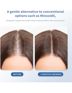 Suero Crecimiento Cabello QGGQ 30ml Roll-On Sin Enjuague 2