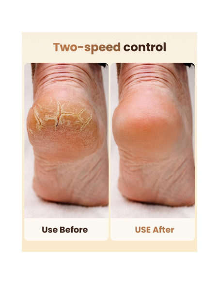 Removedor de Callos Eléctrico SVEMIN MJ-1 con Pantalla Digital Removedor de Callos Eléctrico SVEMIN MJ-1 con Pantalla Digital