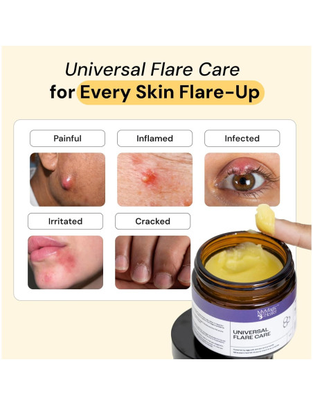 Ungüento Cuidado Flare 2x28.35g - Alivio para Acné y Bultos