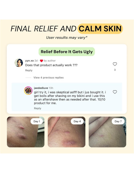 Ungüento Cuidado Flare 2x28.35g - Alivio para Acné y Bultos