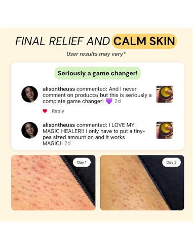 Ungüento Cuidado Flare 2x28.35g - Alivio para Acné y Bultos