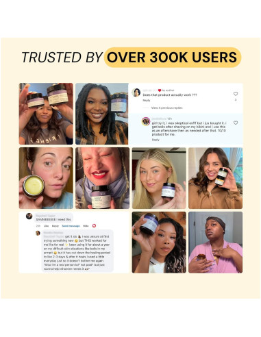 Ungüento Cuidado Flare 2x28.35g - Alivio para Acné y Bultos