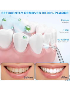 Irrigador Oral Portátil KOOVON Azul IPX7 5 Puntas 4 Modos 2