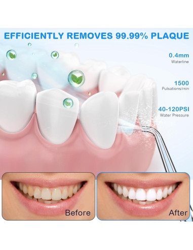 Irrigador Oral Portátil KOOVON Azul IPX7 5 Puntas 4 Modos