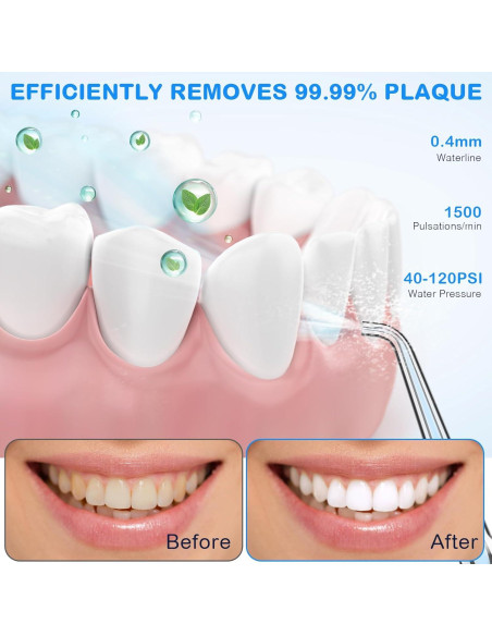 Irrigador Oral Portátil KOOVON Azul IPX7 5 Puntas 4 Modos