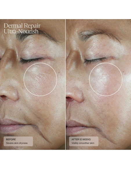 Crema Reparadora Senté 50 ml - Tratamiento Rosácea Piel Seca