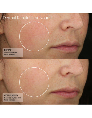 Crema Reparadora Senté 50 ml - Tratamiento Rosácea Piel Seca