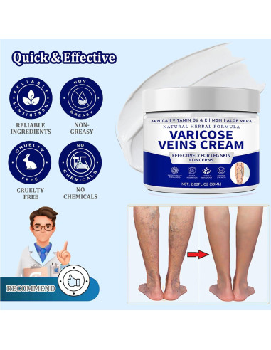 Crema para Venas Varicosas Vivipop - Cuidado Natural 81g