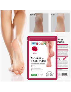 Mascarilla Exfoliante para Pies CGBOOM - 3 Paquetes, Suaviza Callos 2