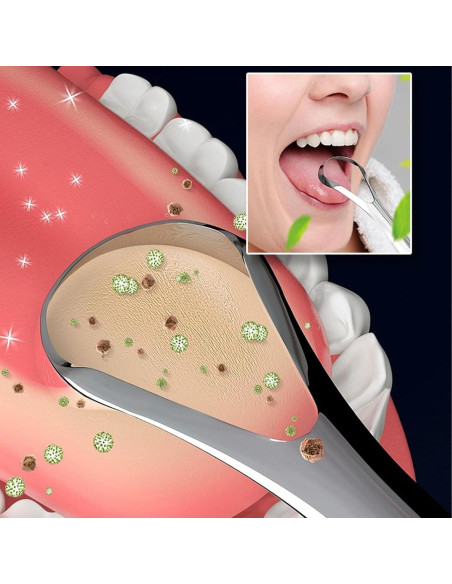 Limpiador de Lengua Acero Inoxidable Qalgtih 2 Piezas