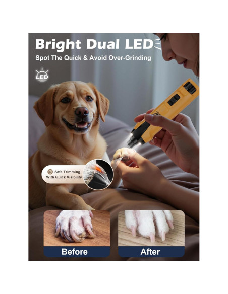 Molinillo de Uñas Eléctrico Casfuy N70 - 6 Velocidades, 2000mAh