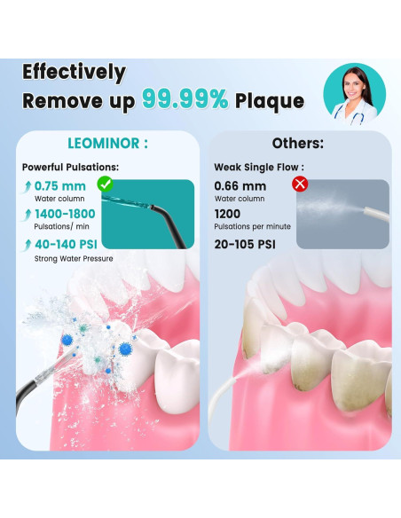 Irrigador Dental Portátil Leominor 300ML IPX7 Recargable Negro