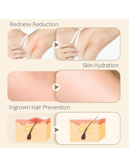 Aceite After Shave Furré 30 ml - Tratamiento Vellos Encarnados