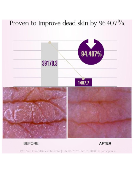 Gel Limpiador Exfoliante CNF 110g - Suave para Cara y Cuerpo