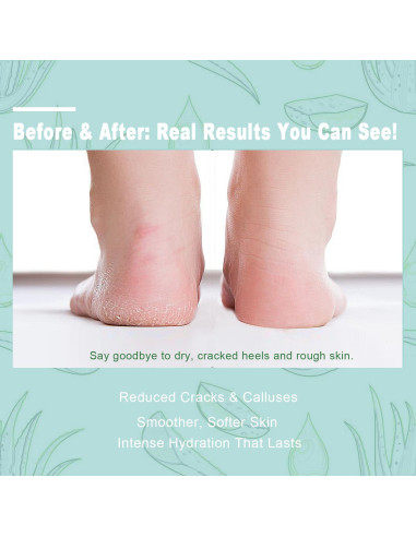 Crema de Urea 60% con Ácido Salicílico 2% - 240 g