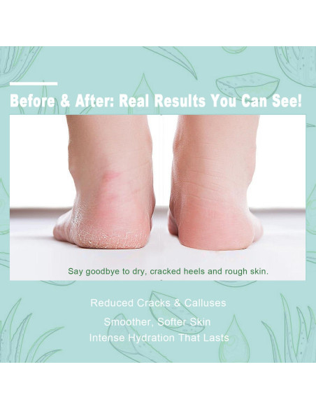 Crema de Urea 60% con Ácido Salicílico 2% - 240 g