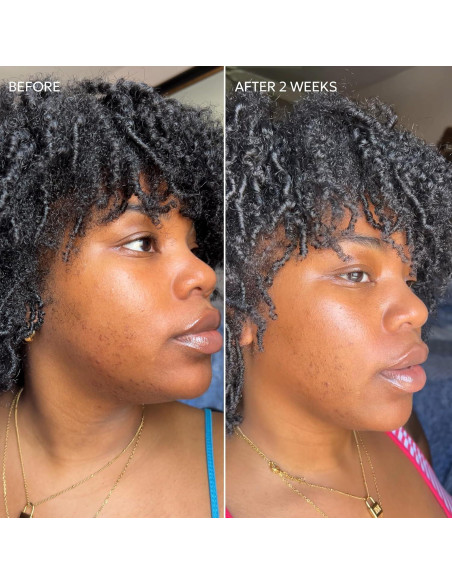 Crema Dermisa con Vitamina C 50.4 g - Aclara Manchas Oscuras Crema Dermisa con Vitamina C 50.4 g - Aclara Manchas Oscuras