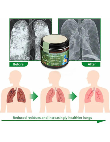 Crema Reparadora de Pulmón Lercea Mullein - Salud Pulmonar