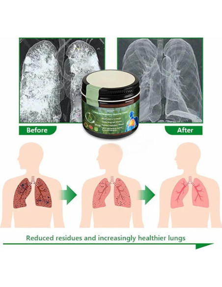 Crema Reparadora de Pulmón Lercea Mullein - Salud Pulmonar