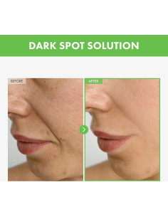 Crema para Imperfecciones TOSOWOONG Kakadu Plum 50g 2