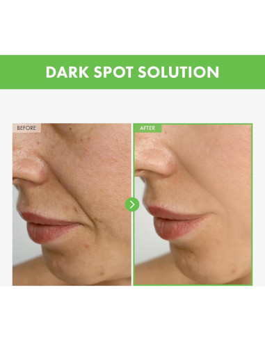 Crema para Imperfecciones TOSOWOONG Kakadu Plum 50g