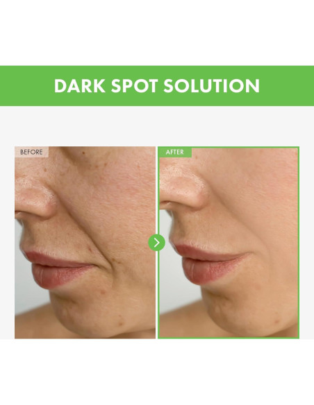 Crema para Imperfecciones TOSOWOONG Kakadu Plum 50g