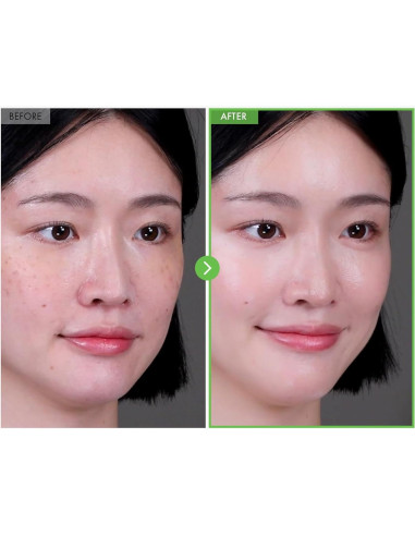 Crema para Imperfecciones TOSOWOONG Kakadu Plum 50g