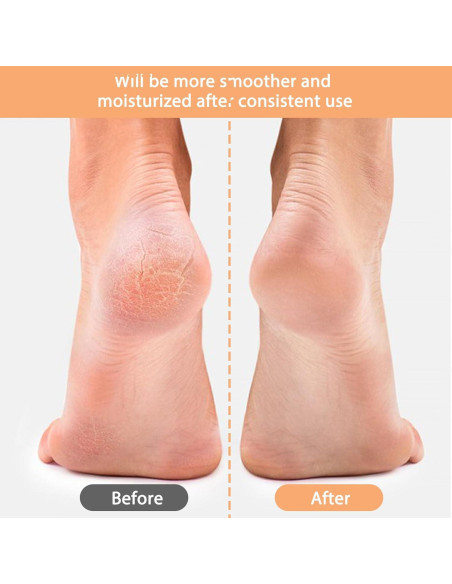 3 Pares Calcetines Hidratantes Gel Abeillo para Talones Agrietados
