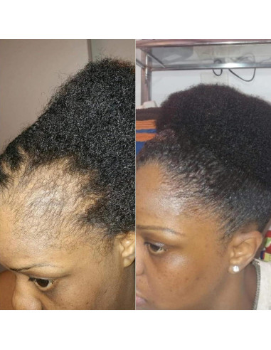 Sérum Hidratante Peppermint Blast 113.4 g - Crecimiento Cabello